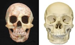 human-skull-changes-no-bones-behind-the-eyes-v0-u80sl861wodc1.jpg